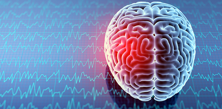 Pain is in the Brain