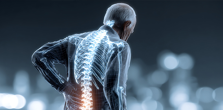 Chronic Back Pain