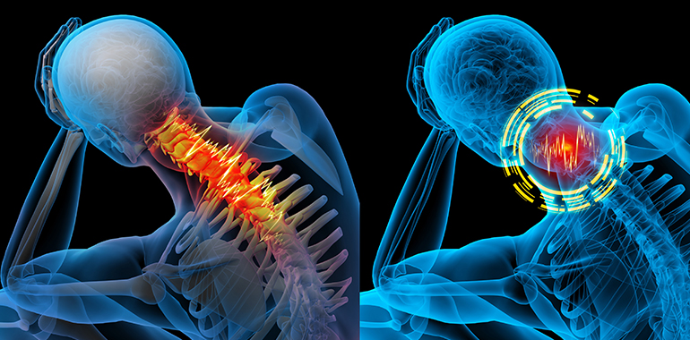 Neck Pain