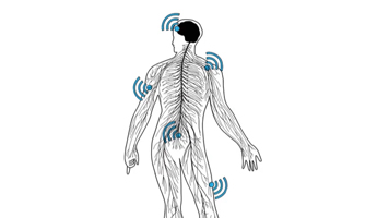 Pain Alarm System